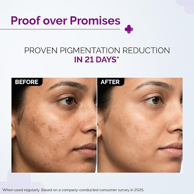 The Derma Co. 2% Kojic Acid Face Serum with Alpha Arbutin for Dark Spots & Pigmentation - Image 3